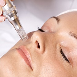 biomicroneedling with collagen induction therapy